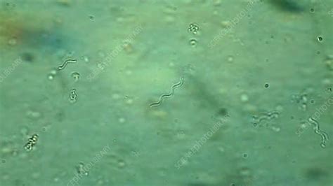 Spiral bacteria in pond water - Stock Video Clip - K003/5545 - Science ...