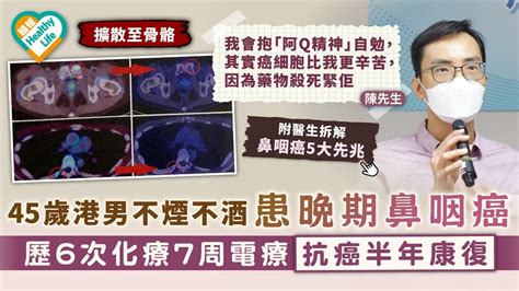 抗癌勇士｜45歲港男不煙不酒患晚期鼻咽癌 歷6次化療7周電療抗癌半年康復｜附鼻咽癌5大先兆 晴報 健康 腫瘤及癌症 D210707