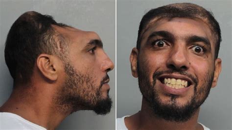 'Half-headed' Miami man from viral mugshot facing arson, attempted ...