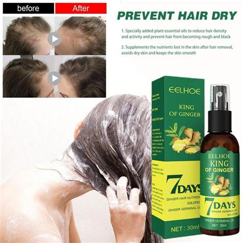 Hold Live Eelhoe Ginger Hair Growth Spray Fast Hair Regrowth Hair