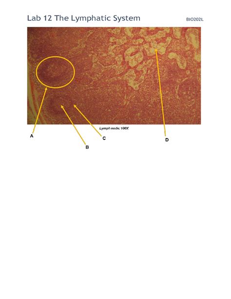 Solution Straighterline Bio L Lab Worksheet The Lymphatic System