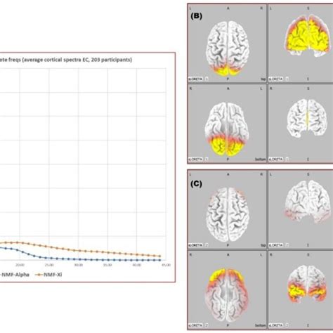 Non Negative Matrix Factorization Of Eloreta Cortical Spectral Power