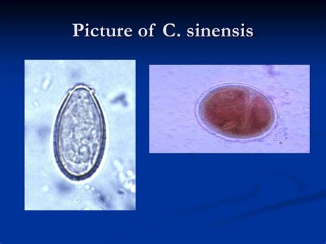 PPT - Clonorchis sinensis PowerPoint Presentation, free download - ID:554202