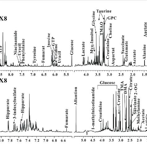 Typical Mhz H Nmr Spectra Of Kidney A And Urine B In