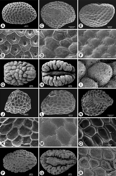 Scanning Electron Microscopy Micrographs Of Seeds And A Detail Of Their