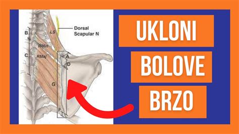 BOLOVI U RAMENU I LOPATICI mobilizacija živca DORZALNI SKAPULARNI