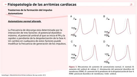 Fisiopatologia De Arritmias Cardiacas En Urgencias Ppt