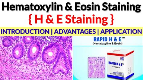 What Is Hematoxylin And Eosin Staining H And E Stain H And E Stain Purpose