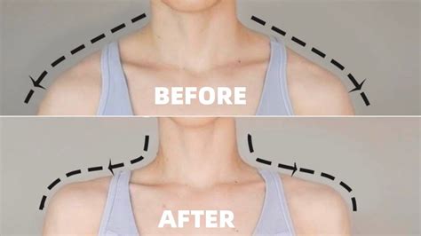 Get Beautiful Neck And Shoulders In 14 Days Fix Posture And Relieve Pain Youtube