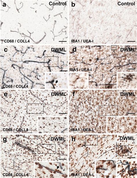 Parenchymal And Perivascular Cd Positive Macrophages And