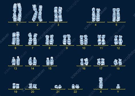 Human Male Karyotype Stock Image C016 6745 Science Photo Library