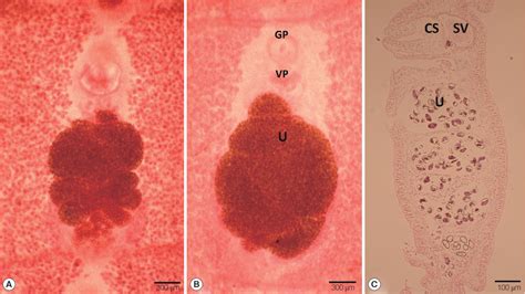 Figure From Identity Of Spirometra Theileri From A Leopard Panthera