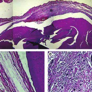 Histological Pictures Of The Materials Implanted In The Calvaria