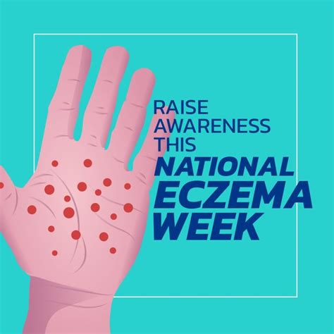 Illustration Of Palm With Atopic Dermatitis And Raise Awareness This National Eczema Week Text