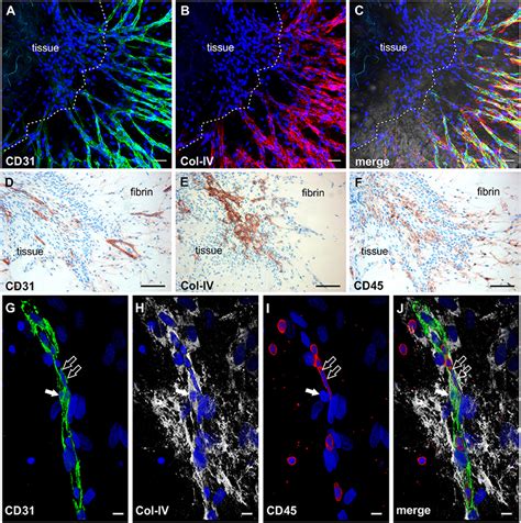 Frontiers Vascular Morphogenesis In The Context Of Inflammation Self Organization In A Fibrin