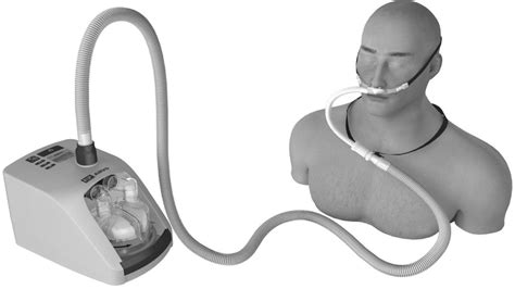 High Flow Nasal Cannula System