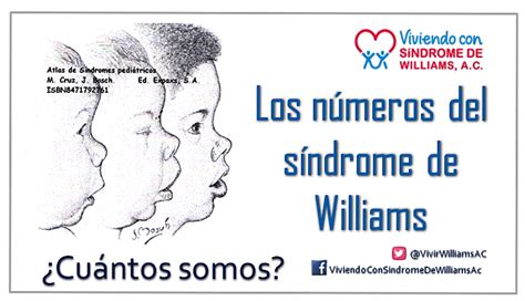 Estadísticas Del Síndrome De Williams En México Viviendo Con Síndrome