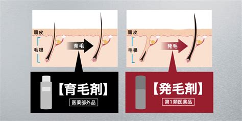 “育毛剤”と“発毛剤”の違いってご存知ですか？ 90％の人が違いを知らないという事実！｜アンファー株式会社のプレスリリース