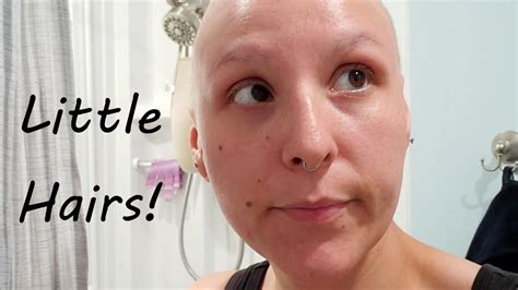 Hair Update After Chemo Radiation Youtube