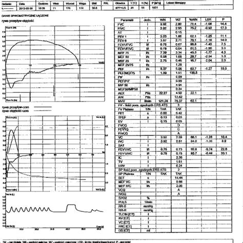 Pulmonary Function Test Download Scientific Diagram