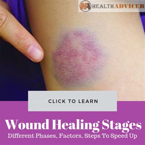 Photos Of Wound Healing Stages