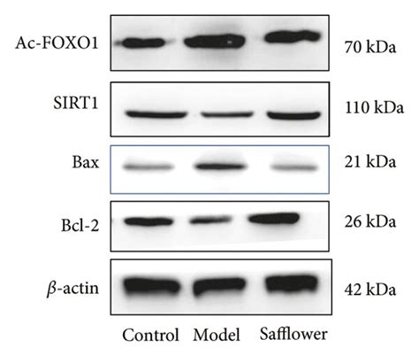 Effects Of Safflower On The Expression Of Ac Foxo1 Stir1 And Bax Download Scientific Diagram