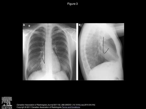 Chest Radiographs Are Valuable In Demonstrating Clinically Significant