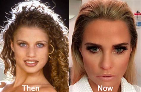 Katie Price Before And After Latest Plastic Surgery Gossip And News