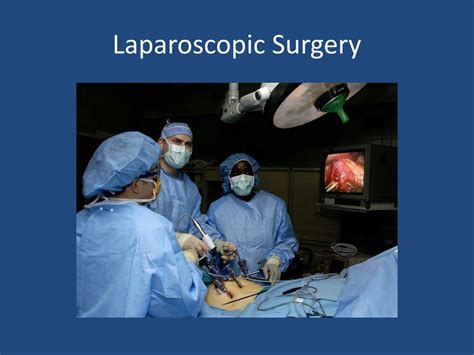 Ppt Laparoscopic Surgery Powerpoint Presentation Free Download Id 1385303