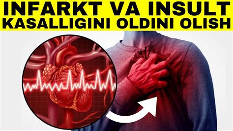 Yurak Qon Tomir Kasalliklari Haqida Siz Bilmagan Faktlar Infarkt