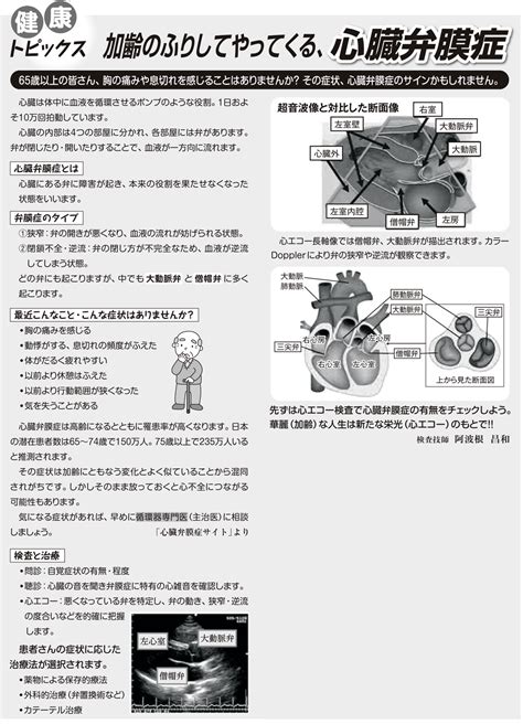 かすかべ生協診療所｜コラム 加齢のふりしてやってくる、心臓弁膜症