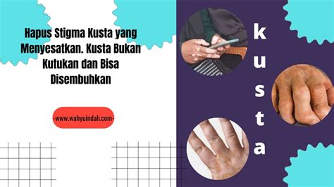 Hapus Stigma Kusta Yang Menyesatkan Kusta Bukan Kutukan Dan Bisa