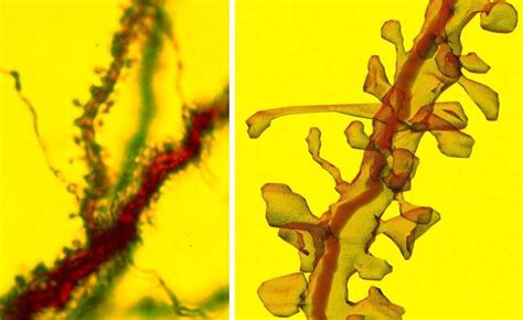 Morphology Of Dendrites Synapseweb