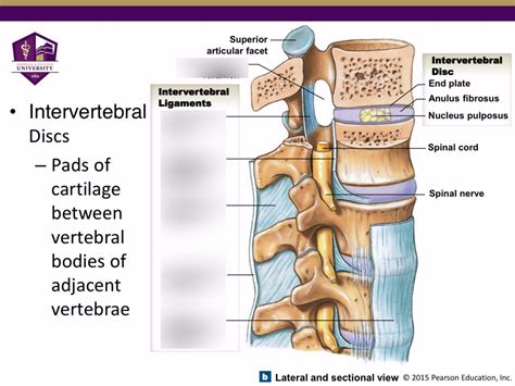 Intervertebral Ligaments Side View Diagram Quizlet