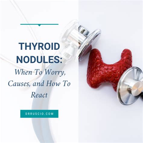 Thyroid Nodules When To Worry Causes And How To React Artofit