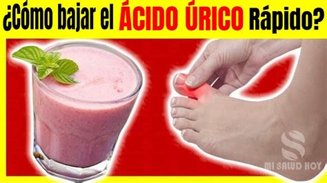 COMO BAJAR EL ACIDO URICO O LA GOTA RAPIDO Con Este Remedios