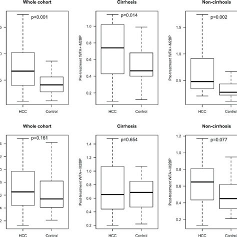 Pre Treatment And Post Treatment Wfa M2bp Levels Between The Hcc And