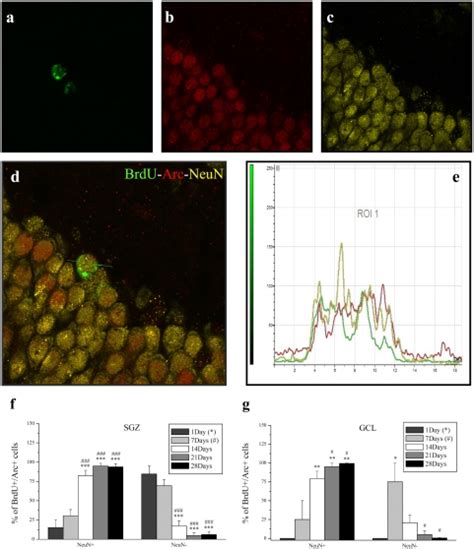 A Confocal Image Of Brdu Green B Arc Red C Neun Yellow D