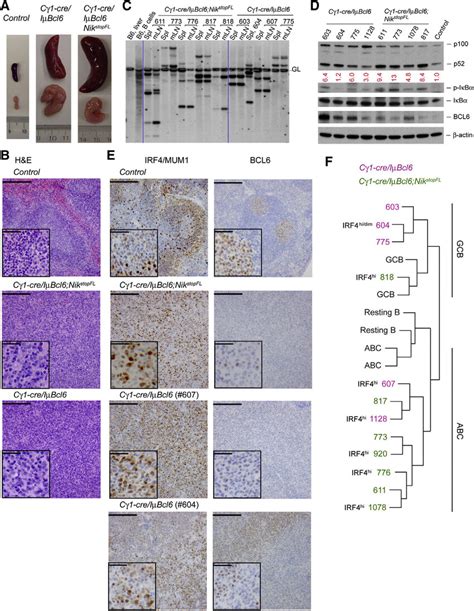 Constitutive Alternative Nf Kb Activation Synergizes With Bcl In Dlbcl