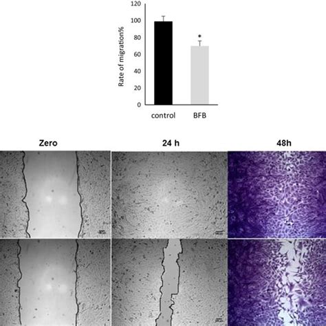 The Wound Healing Assay In Mcf Cells A Untreated Cells B Cells