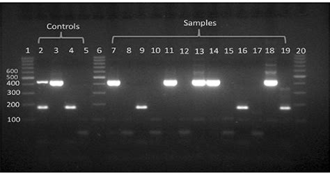 Agarose Gel Electrophoresis 18 Tae Of 16s Like Rrna Ssu Rrna