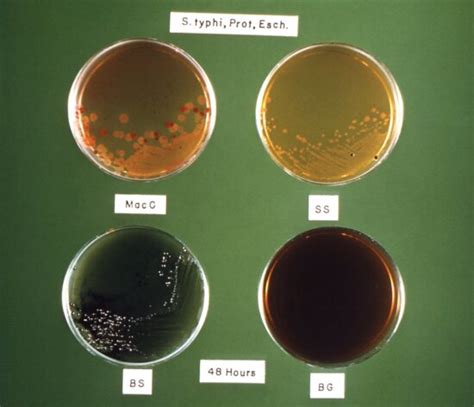 Free Picture Gram Negative Escherichia Coli Bacteria O157 Coli O157 Bacterium