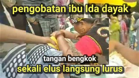 Ibu Ida Orang Dayak Mengobati Tangan Yang Bengkok Langsung Sembuh