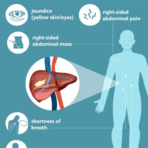 Liver Cancer Overview And More