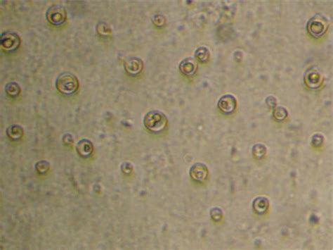 Cryptococcus neoformans in MODS plate at ×400 magnification with ...