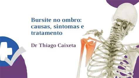 Bursite No Ombro Causas Sintomas E Tratamento