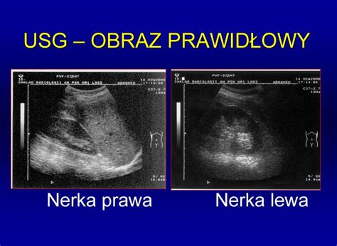 Diagnostyka układu moczowego przestrzeni zaotrzewnowej i narządu