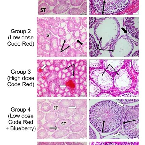 Sections From Rat Testis Immunostained For Caspase 3 Apoptotic Marker