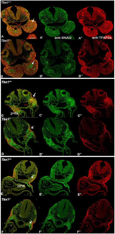 TFAP2A And SNAI2 Highlight Regionalization Defects In Tbx1 Embryos