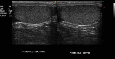 Senologia Napoli Ecografia Testicolare